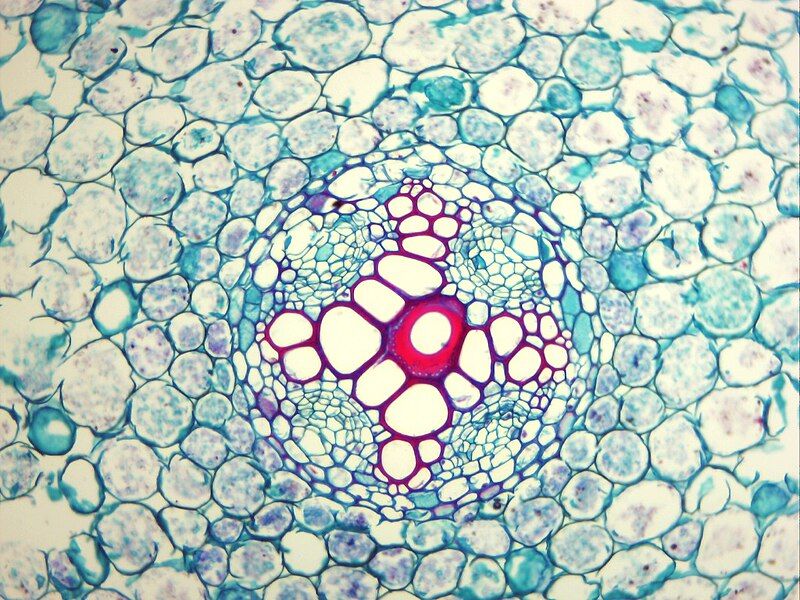 File:Xylem Stained.jpg