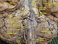 Cerebrum. Inferior view. Deep dissection.