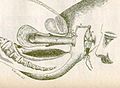 Hysteroscopy, 1808