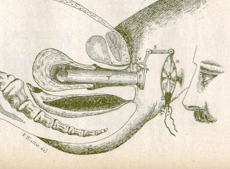 File:Hysteroscopy1898.jpg