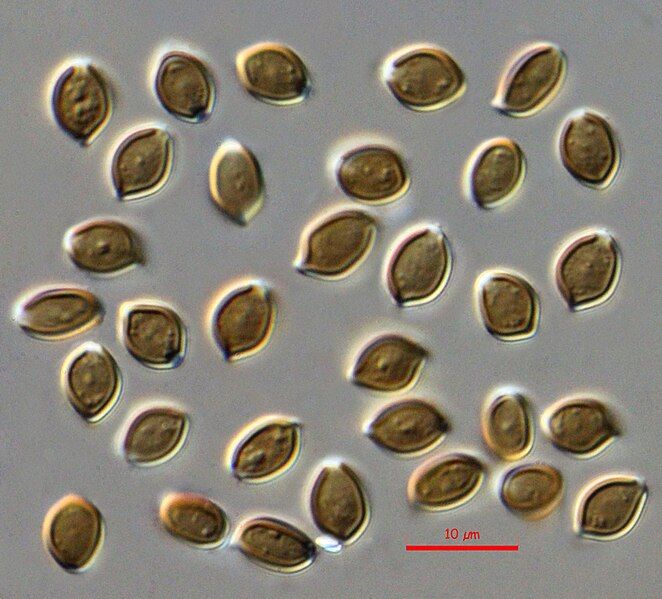 File:Psilocybe.caerulescens.spores.1000x.dic.JPG