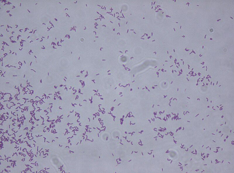 File:Rhodococcus fascians.jpg