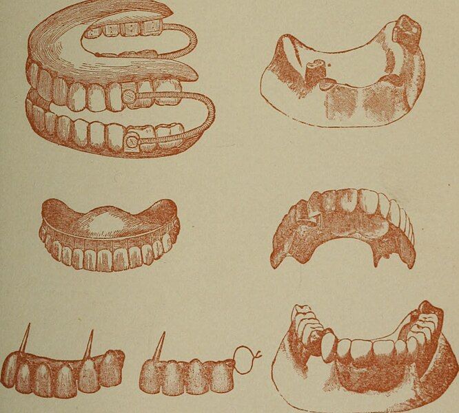 File:Dental prosthesis (1893).jpg