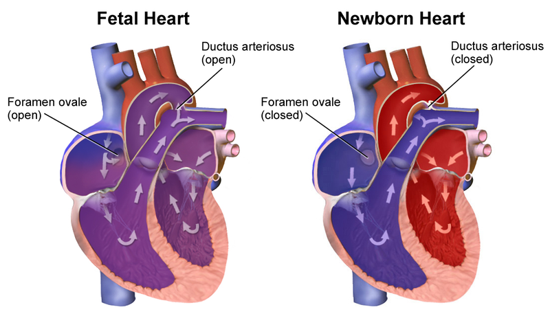 File:Neonatal Heart Circulation.png