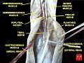 Tibial nerve