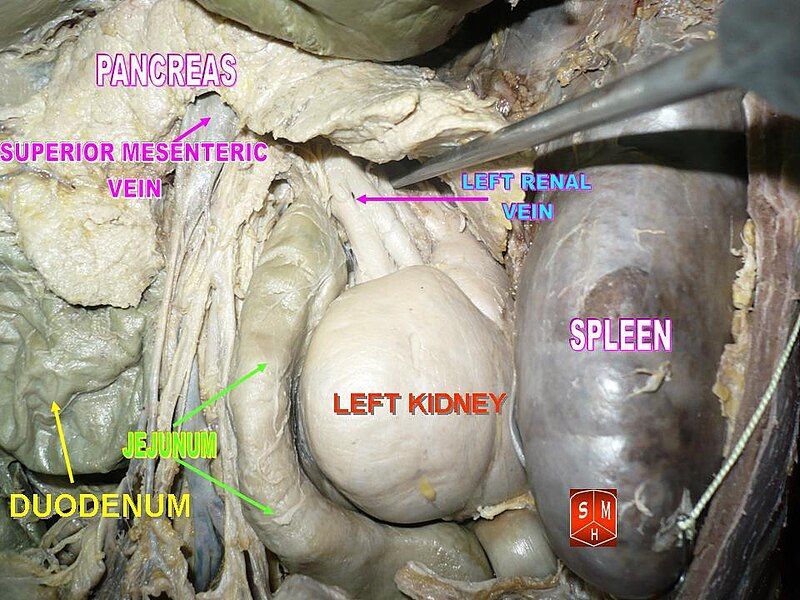 File:Left kidneys.jpg