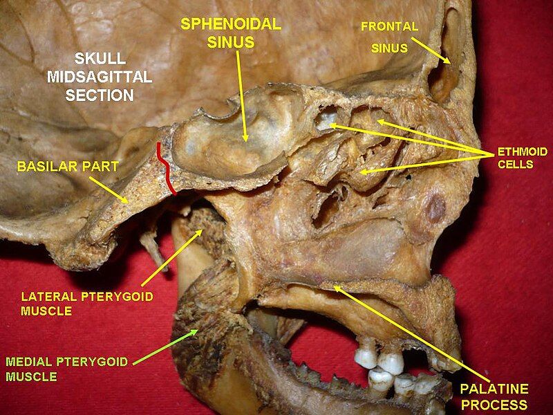 File:Slide7rr.JPG