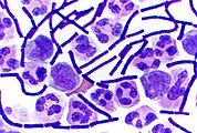 Understanding the metabolism of bacteria in order to see how their proliferation effects the climate