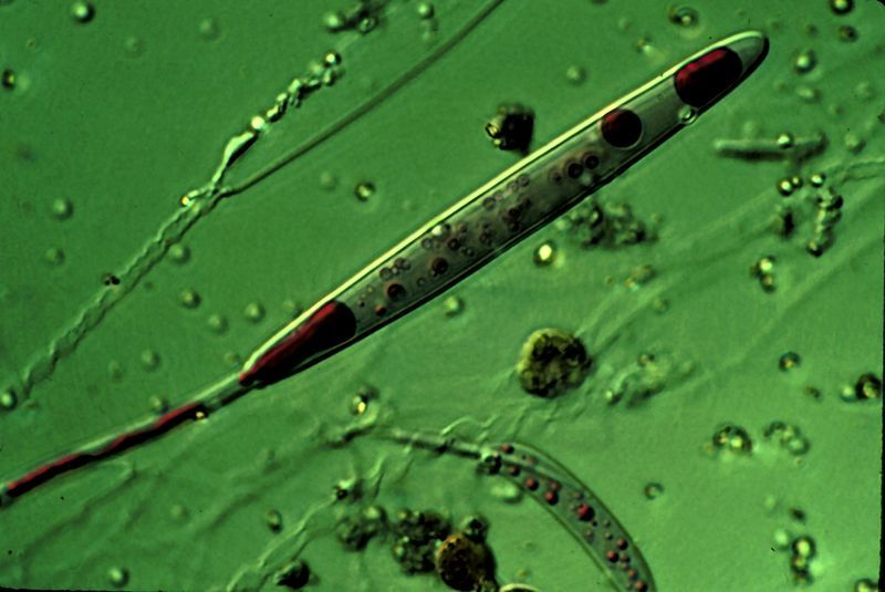 File:Nematocyst1.jpg