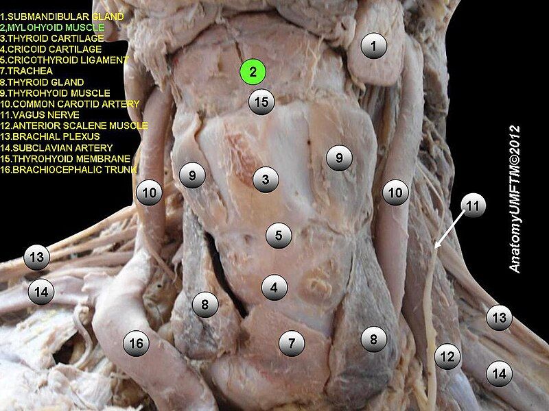 File:Slide2e.JPG