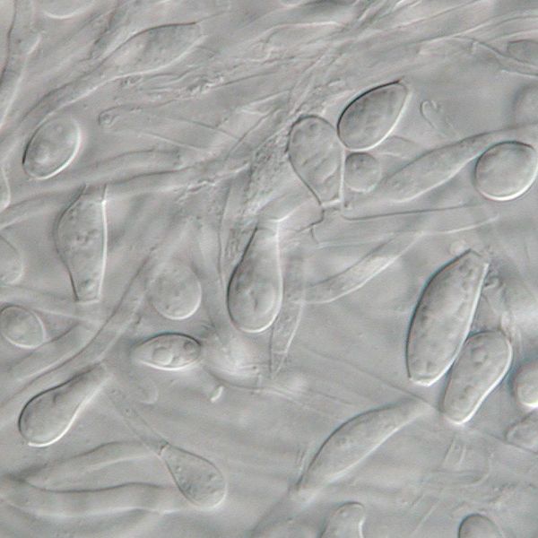 File:Chrysosporium keratinophilum.jpg