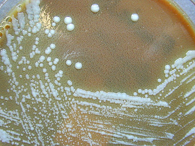 File:Francisella tularensis 01.jpg