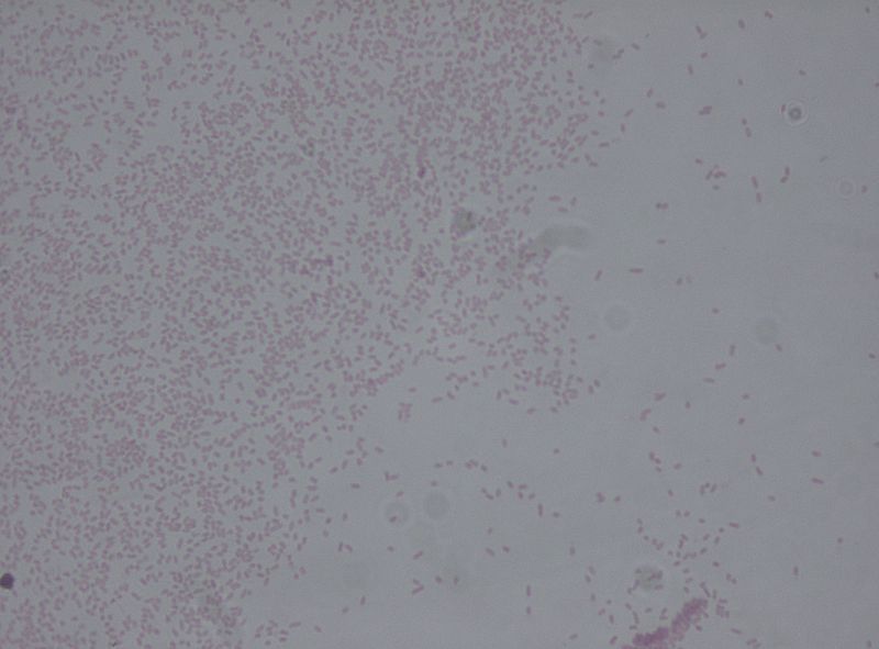 File:Pantoea agglomerans.jpg