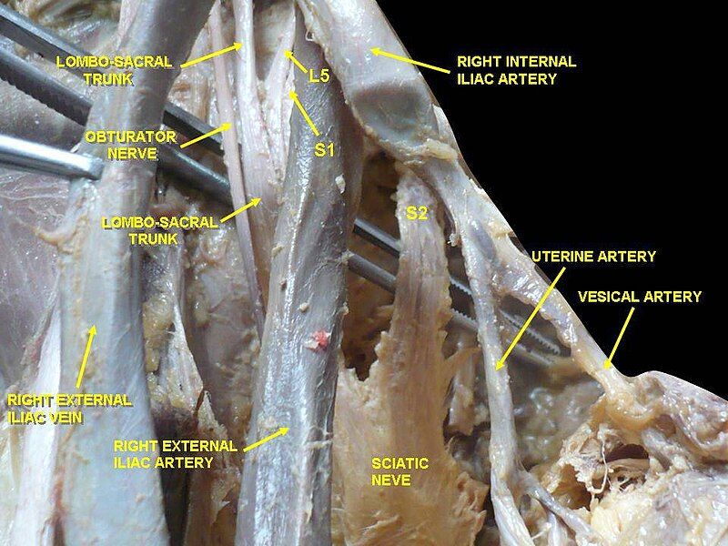 File:Slide4Anat.JPG