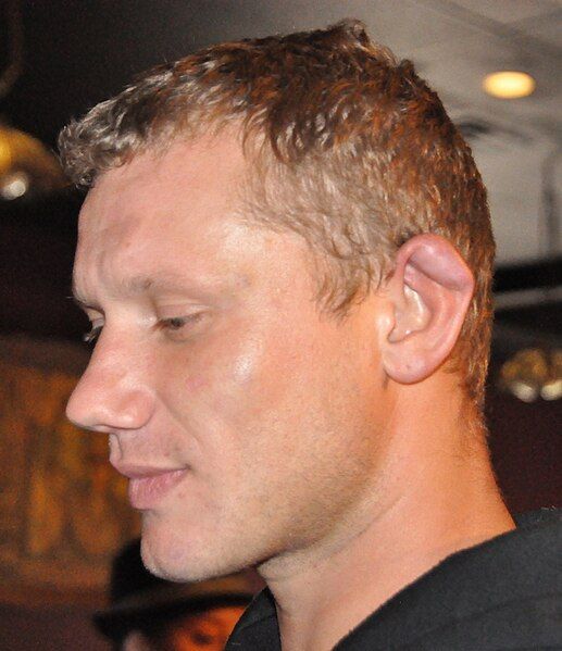 File:Shawn's cauliflower ear.jpg