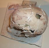 Human skull with traces of trepanation discovered from Chalagantepe settlement, Azerbaijan History Museum