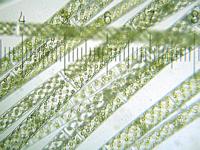 File:20090523 213732 Spirogyra.jpg