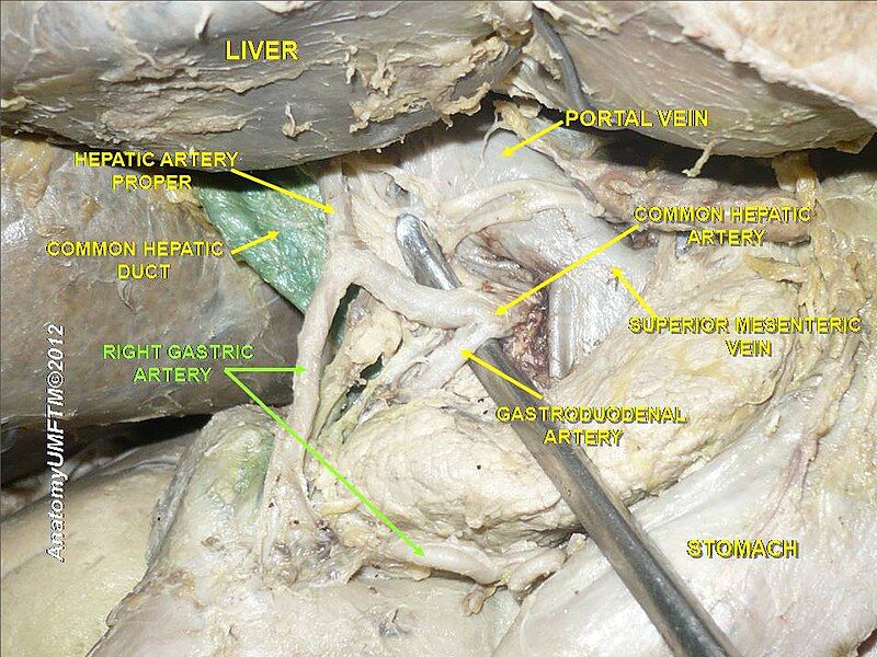 File:Slide14fff.JPG