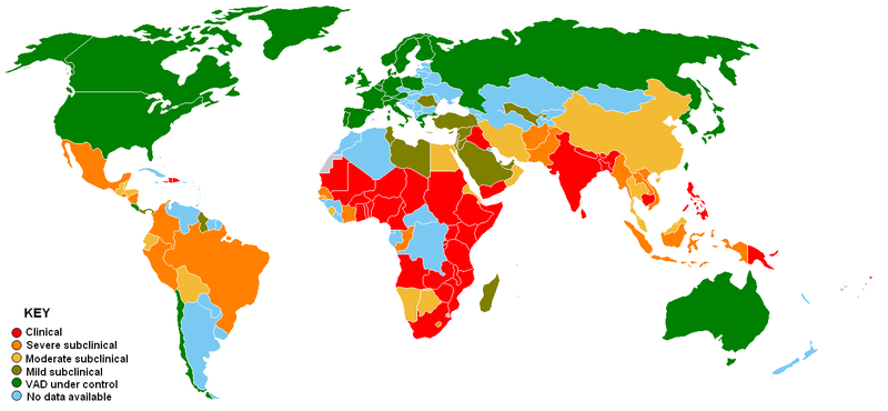 File:Vitamin A deficiency.PNG