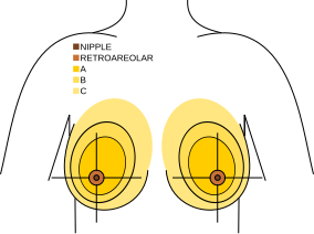 File:Breast quadrants ABC.svg