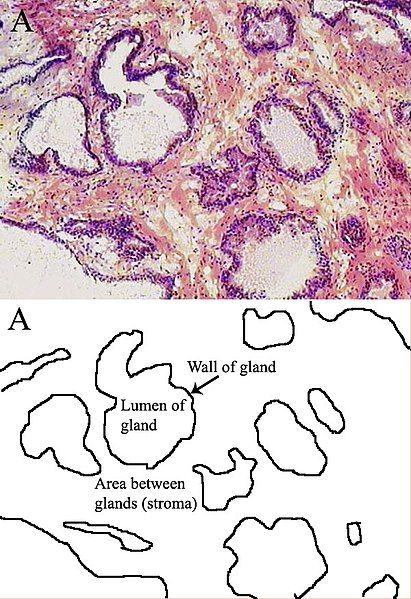 File:Prostatehistology.jpg