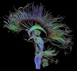 Diffusion tensor imaging