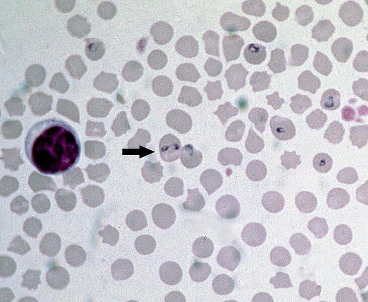 File:Babesia-bovis-piroplasms-cattle.jpg