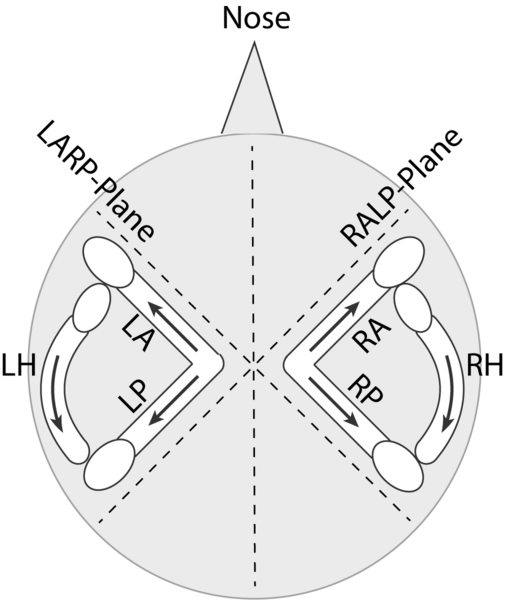 File:Semicircular Canals.png