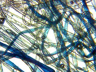 Denim fibers from an old pair of jeans through a microscope