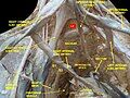 Lumbar and sacral plexus. Deep dissection. Anterior view.