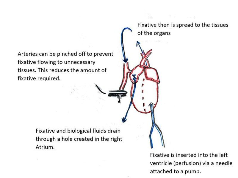 File:Perfusion Diagram.jpg