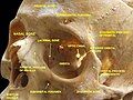 Cranium. Supraorbital foramen.