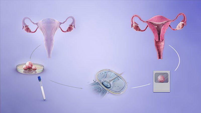 File:IVF.jpg