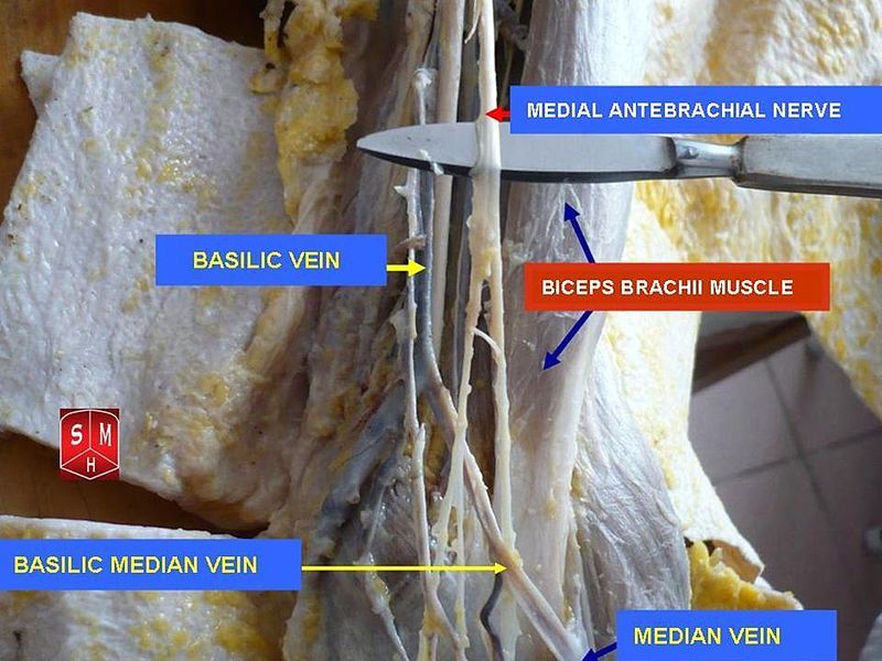 File:Medial antebrachial nerve.jpg