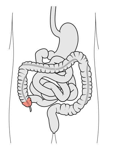 File:Tractus intestinalis cecum.svg