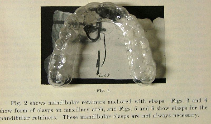 File:Retainers.jpg