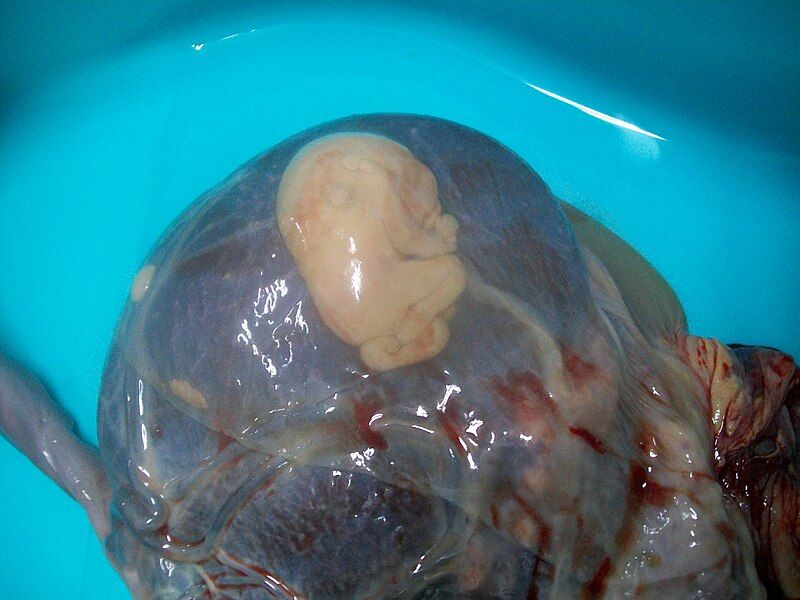 File:Fetus papyraceus.JPG