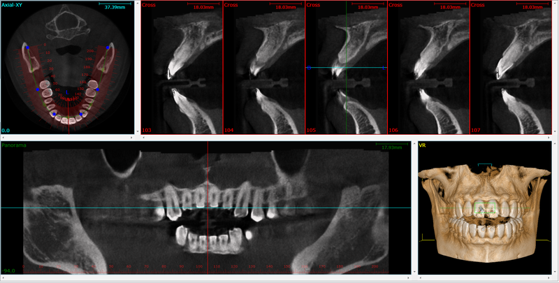 File:CBCT image 03.png