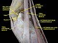 Dorsum of Foot. Ankle joint. Deep dissection