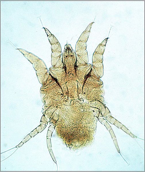 File:Psoroptes-mite-female-3.jpg