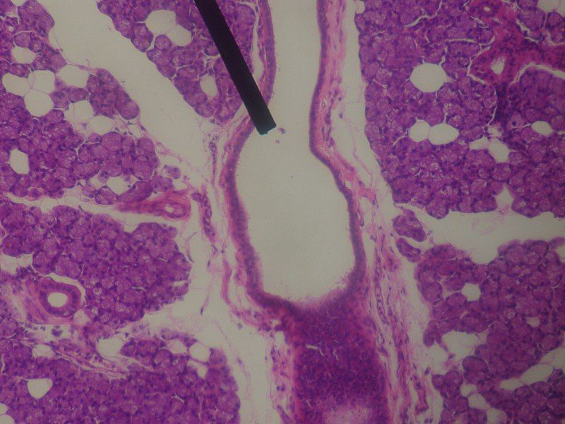 File:Parotid-interlobular duct.JPG