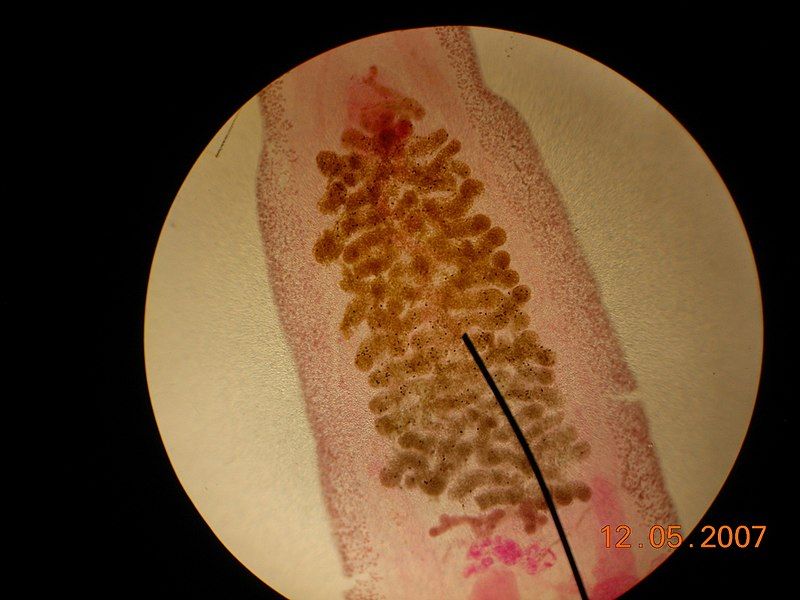 File:Clonorchis.jpg