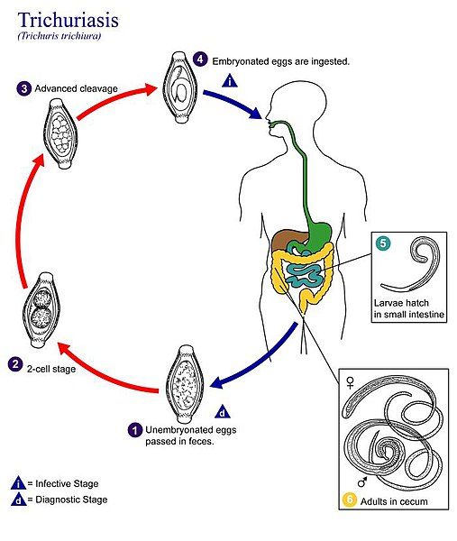 File:Trichuriasis lifecycle.jpg