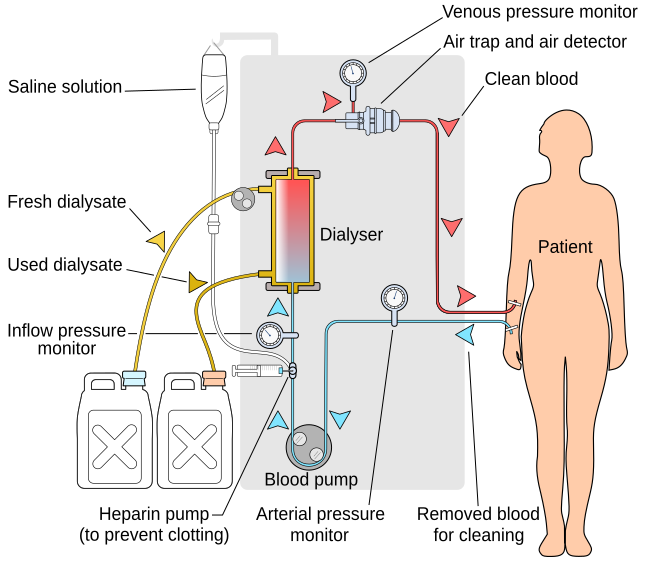 File:Hemodialysis-en.svg