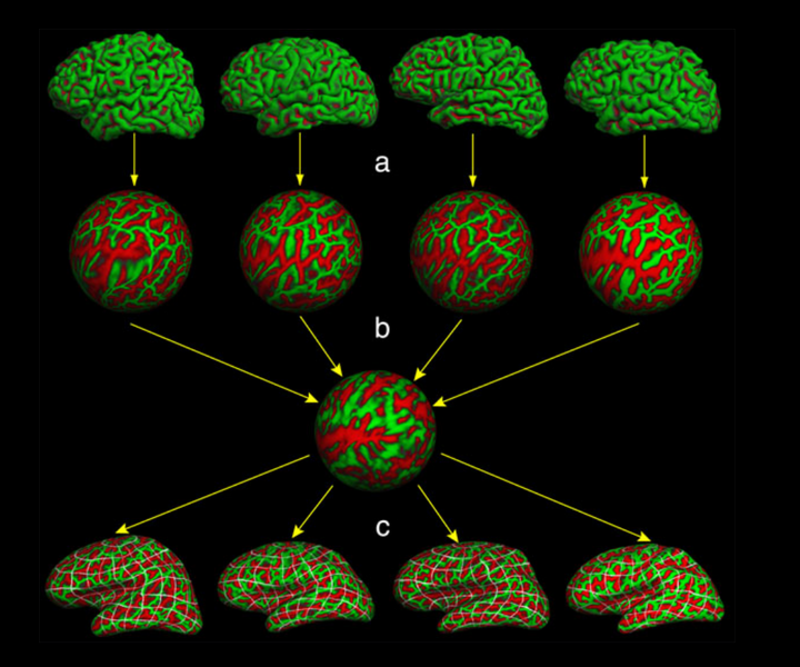 File:Spherical Registration.png