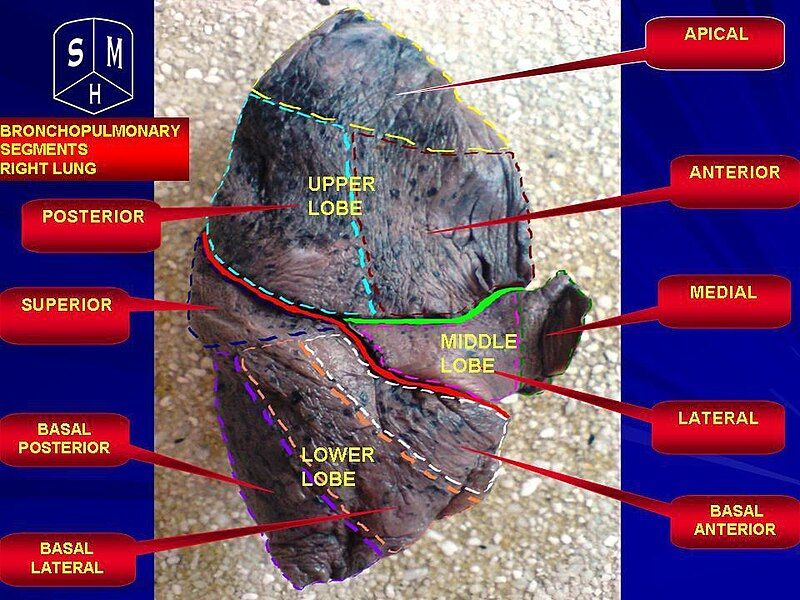 File:Right lung.jpg