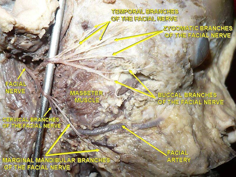 File:Slide1BAB.JPG