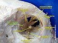 Medial rectus muscle