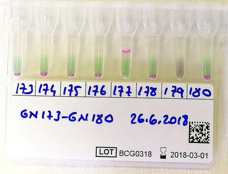 File:Coombs Gel Test.jpg