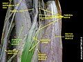 Adductor longus muscle